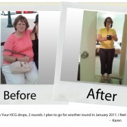 your-hcg-before-after_karen your-hcg-before-after_karen